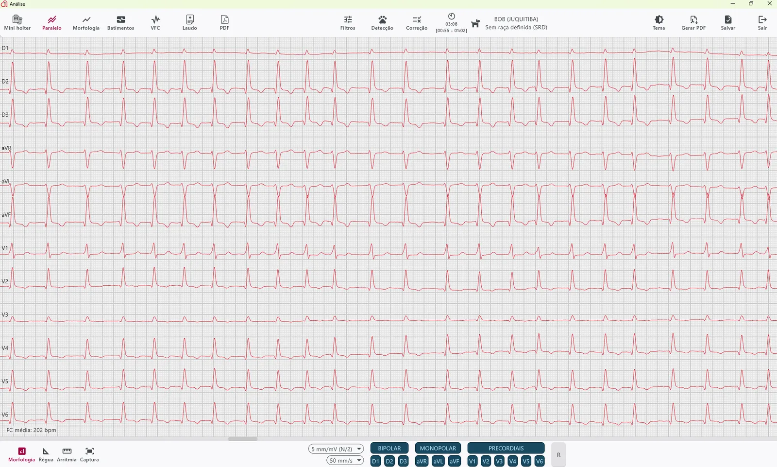 Análise de ECG de 12 derivações no INpulse One