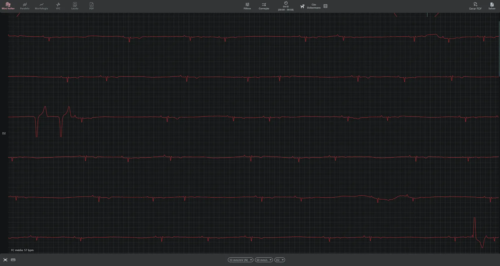 Traçado de ECG contínuo (full disclosure) no INpulse One